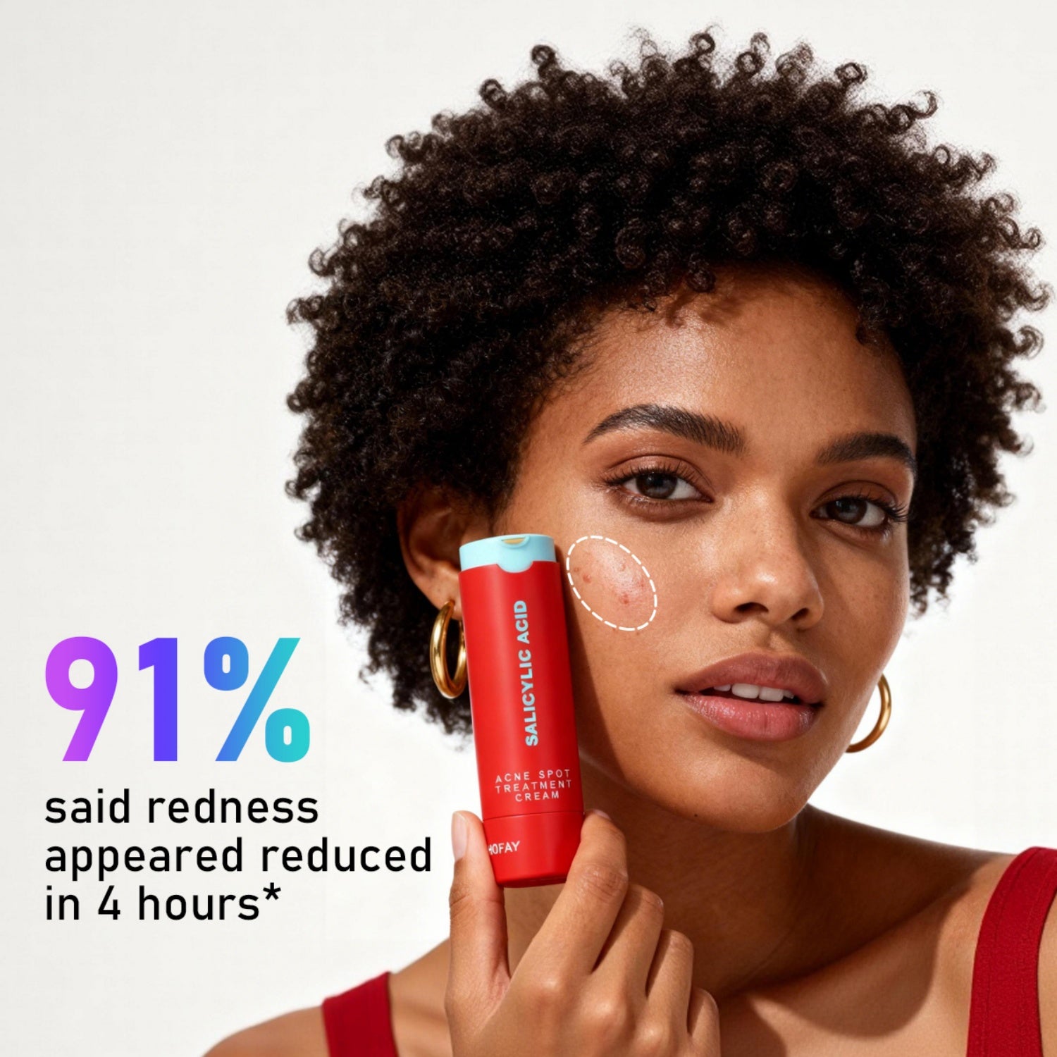 C-S003 Acne Removing Lotion