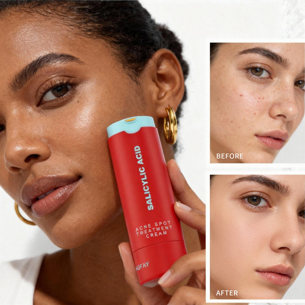 C-S003 Acne Removing Lotion